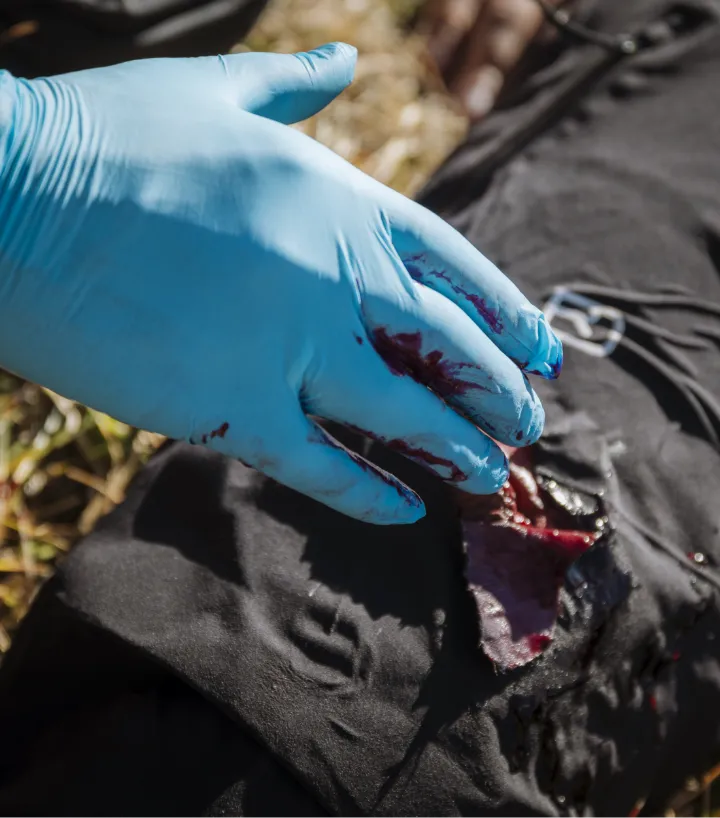 glove, blue, latex-free, blood, wound, hand
