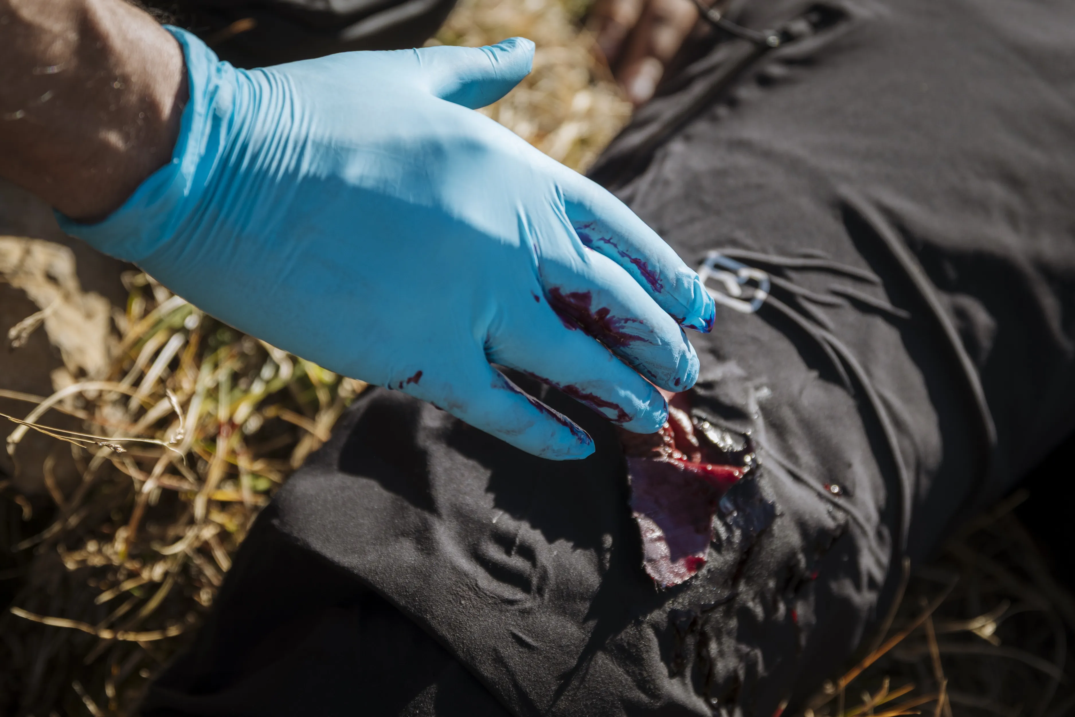 gloved hand, blue glove, blood, wound, fabric patch, glove, blue gloves, blood, gloved hand, medical glove, gloved hand, blue gloves, blood, crime scene, wet blood, glove, blue gloves, blood, bare skin, gloved hand