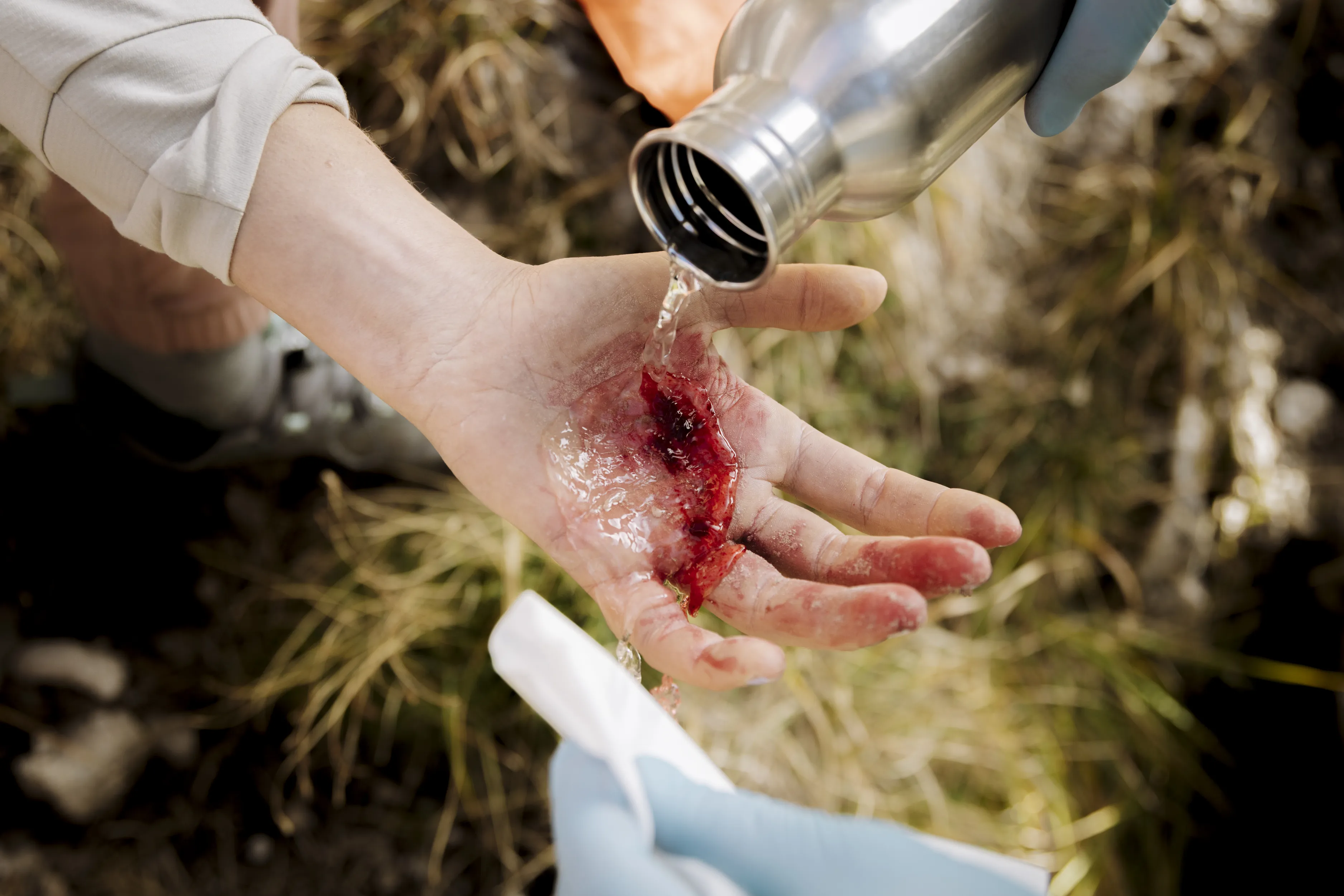 first aid, injury, blood, hand, bandage
